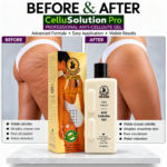 Anti Cellulite Gel